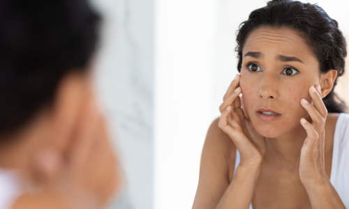 Healing Your Leaky Gut: Understanding and Managing Intestinal Permeability